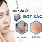 Bớt sắc tố: Tất tần tật điều nên biết