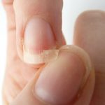 Cách chăm sóc móng tay yếu bằng 7 thói quen đơn giản