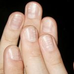 Tất tần tật về cách dưỡng & chăm sóc móng tay bị hư tổn